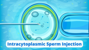 Intracytoplasmic Sperm Injection- A complete know-how for infertility